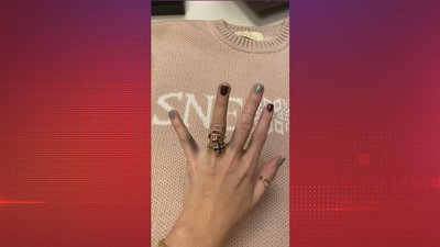 «Бог наказал за чужую ювелирку»: У Ксении Собчак почернели пальцы от новых колец