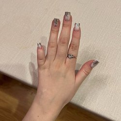 Инцидент в Sunlight: сотрудницу с инвалидностью уволили в первый день из-за «непрезентабельной» руки