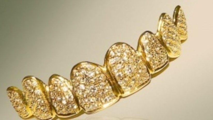 В Дубае стоматологи изготовили золотые накладки на зубы