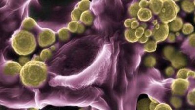 В Австралии нашли грибы, выделяющие золото